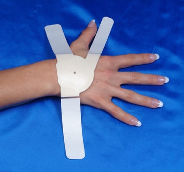 Carpal Solution CTS Therapy