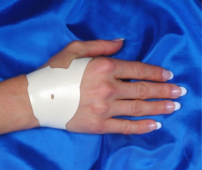Carpal Solution CTS Therapy